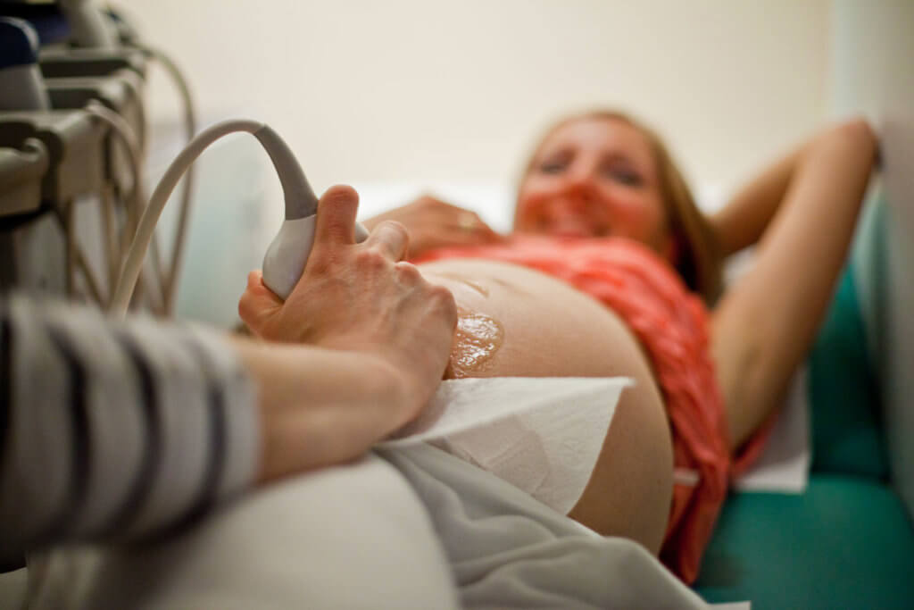 Echo tijdens de zwangerschap bij Verloskundigenpraktijk Bijlmermeer